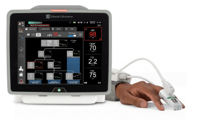 Der Acumen&nbsp;IQ Sensor aktiviert die Acumen Hypotension Prediction Index Software.